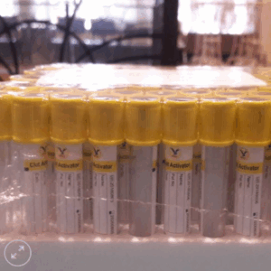 Ống Chân Không Serum Clot Activator – Nachang