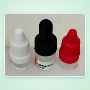 Hóa chất xét nghiệm ASO Latex (Antistreptolysin O) – Spectrum