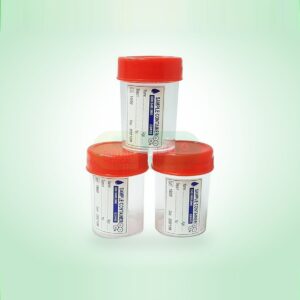 Lọ đựng bệnh phẩm 50/55 ml